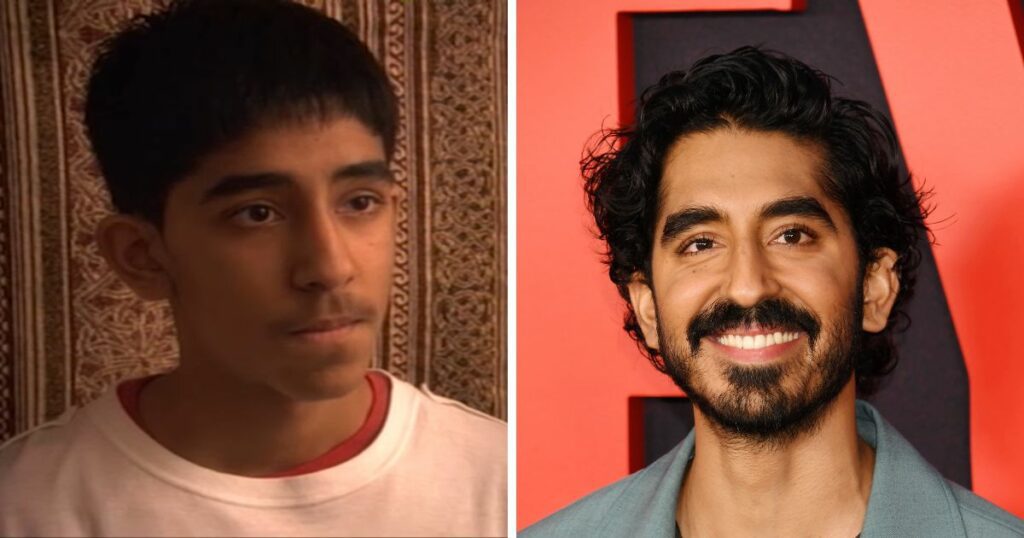 Dev Patel since Skins